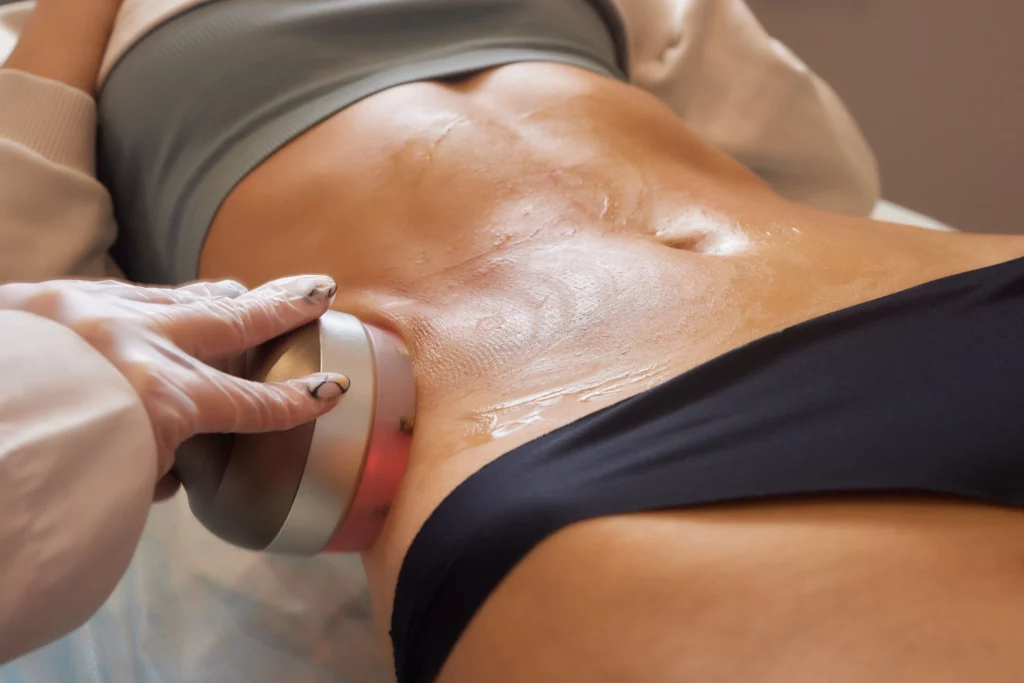 Evolve by Inmode for Abdomen | Elko Replenish Med Spa | Elko, NV