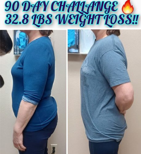 Weight Loss Treatment Before and After Images | Elko Replenish Med Spa | Elko, NV