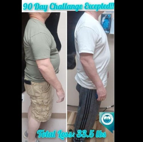 Weight Loss Treatment Before and After Images | Elko Replenish Med Spa | Elko, NV