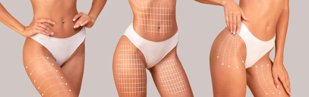 Non-surgical body contouring for toned legs at Elko Replenish Med Spa